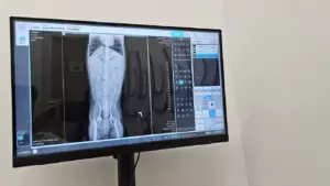 Xray Xray