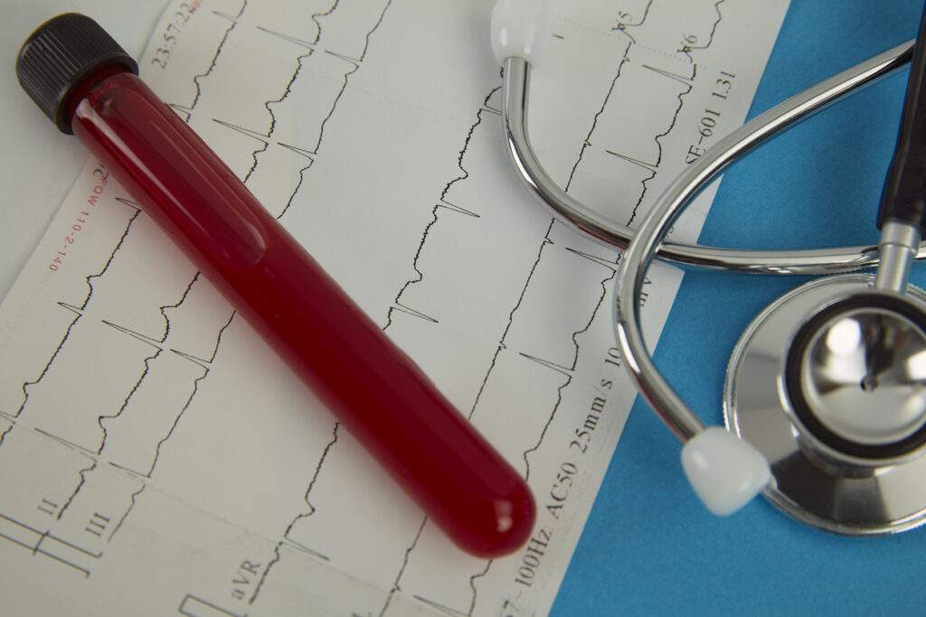 Positive blood test result for the new rapidly spreading Coronavirus pet blood work for dogs and cats